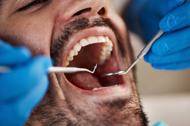 Best Emergency TMJ Treatment in Gibsonburg, OH