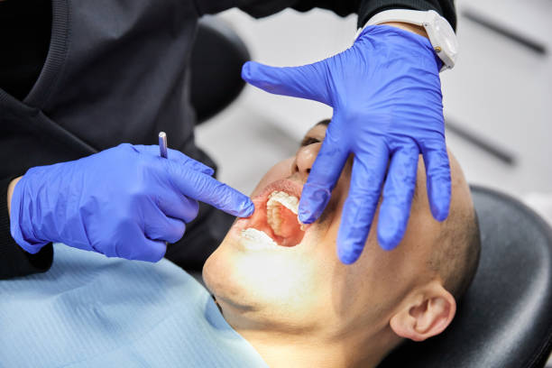 Best Urgent Care for Lost Fillings or Crowns in Gibsonburg, OH